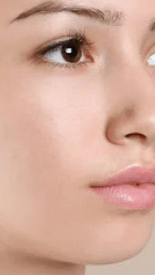 After - Problema: Acné